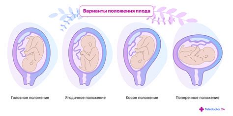Как определить активность плода