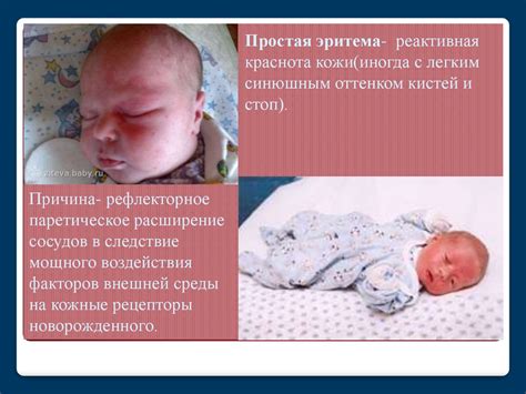 Когда случается первый перекрест крови у недоношенных новорожденных