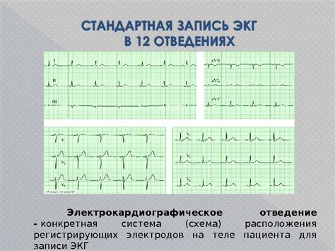 Колготки и ЭКГ: связь между ними