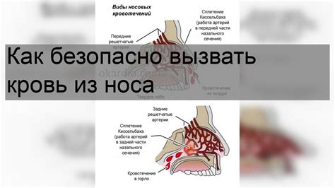 Кровотечение из носа