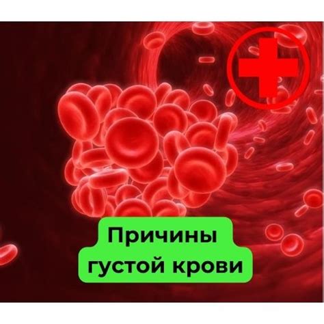 Лечение густой крови у женщин
