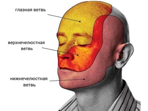 Медицинские методы облегчения тошноты при невралгии