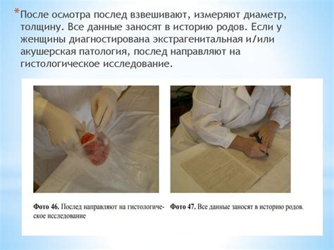 Методы выделения плаценты по гентеру