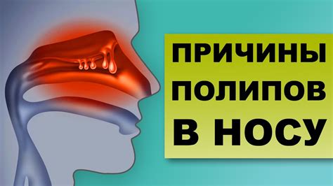 Методы диагностики ангидака в носу