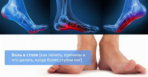 Механизм действия: почему парение ног может помочь при флюсе