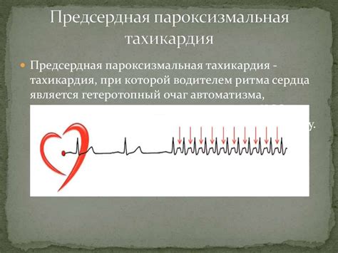 Одышка при тахикардии: причины и механизмы