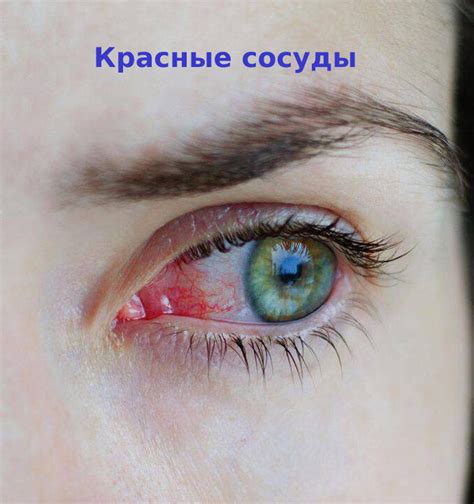 Окалина в глазе может вызывать различные неприятные симптомы