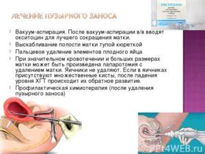 Определение оптимального момента для вакуумной аспирации после кесарева