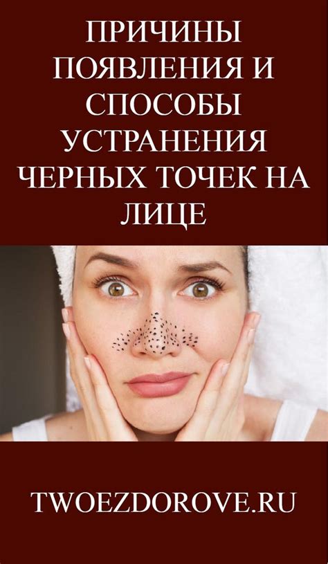 Основные причины появления черных точек