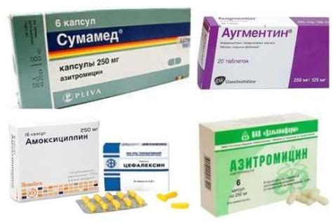 Основные типы антибиотиков для лечения горла