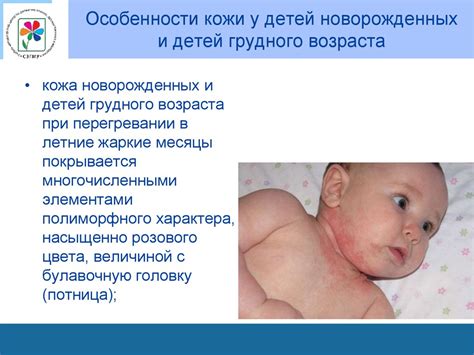 Особенности кожи у малышей