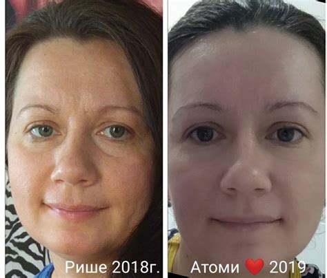 План массажа глаз при использовании гидрофильного масла