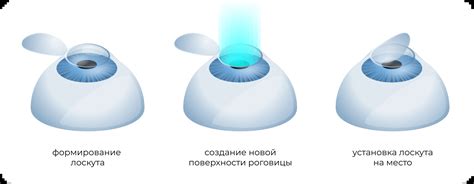 Подготовка к ламинированию ресниц после лазерной коррекции