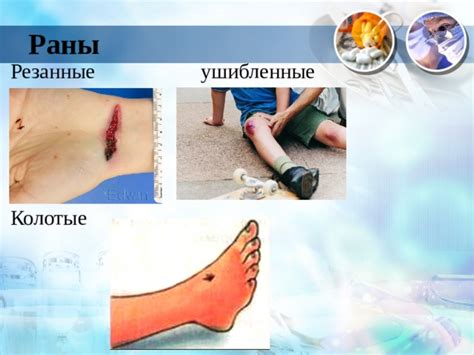 Последствие 1: Травмы и ушибы