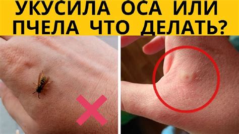 После прогулки: как проверить себя и что делать при укусе