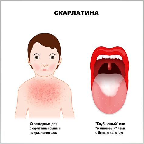 Преимущества и рекомендации по использованию спании на боку в коконе