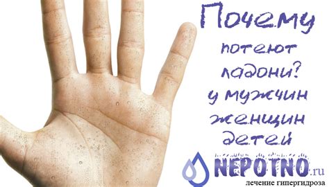 Причины потливости рук у подростков
