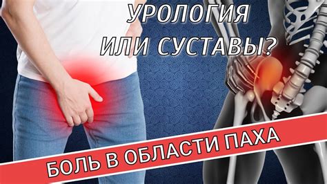 Проблема пота в области паха