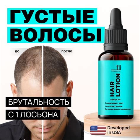 Проведение профилактических мер для роста волос
