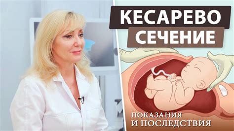 Пуповина и ее роль при родах через кесарево сечение