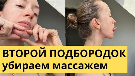 Распознавание типов второго подбородка