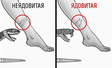 Расшифровка сна о укусе змеи