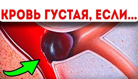 Рекомендации при повышенной плотности крови