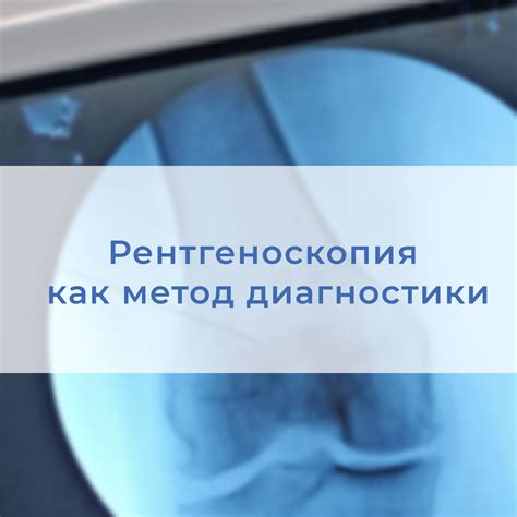 Рентген как основной метод диагностики