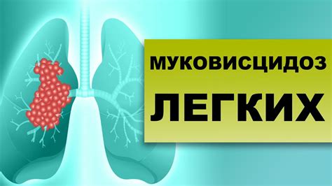 Риски и последствия посещения парных при заболевании