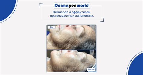 Роль гормонального фона в возрастных изменениях носа