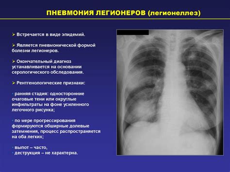 Снижение вероятности заболеваний дыхательных путей