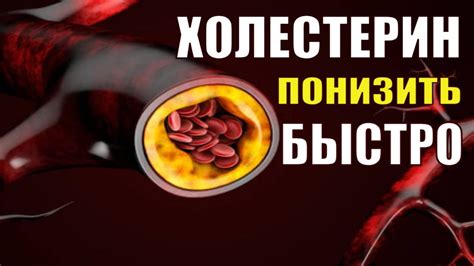 Снижение уровня холестерина