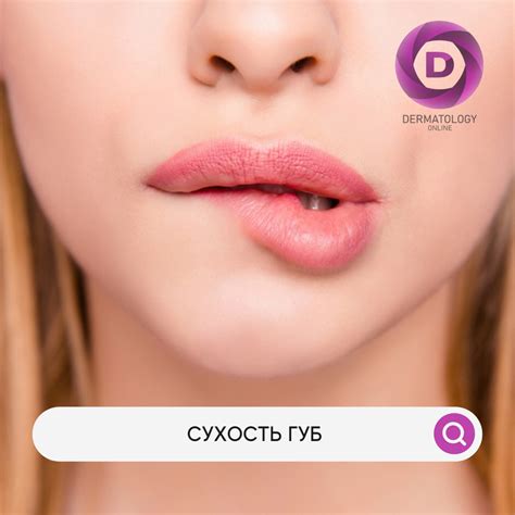 Сухость уголков губ: причины и витамины