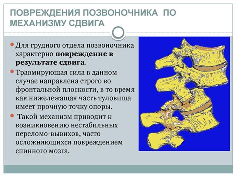Травма позвоночника - причина неучастия