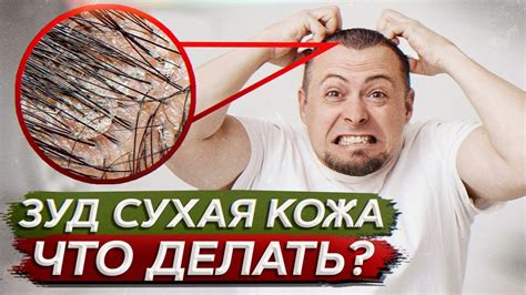 Усиление зуда головы при нарушенной гигиене