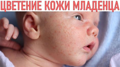 Учитывайте чувствительность кожи младенца