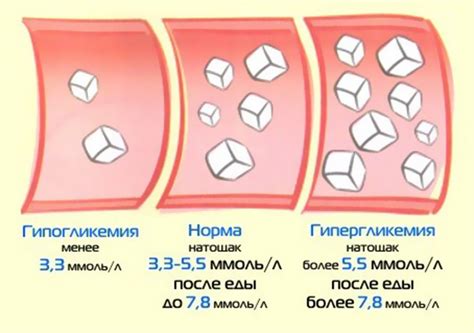 Факторы, влияющие на уровень сахара в крови