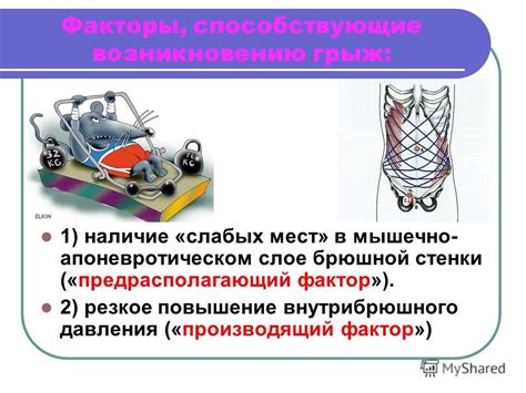 Факторы, способствующие полному срастанию грудины