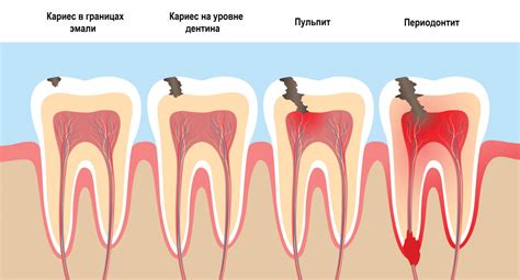 Флюс ног: что это такое и какие симптомы сопровождают его