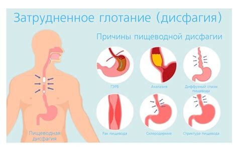 Функциональные нарушения пищевода