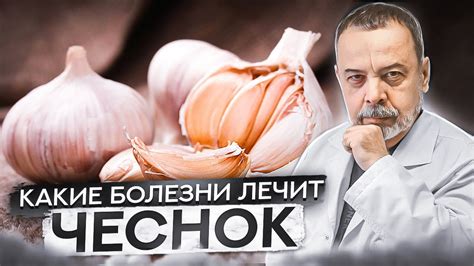 Чеснок и давление: мнения врачей и пациентов