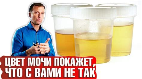 Что говорит о прозрачной моче