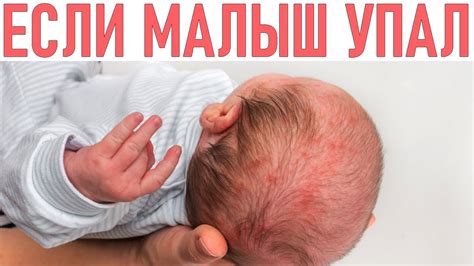 Что делать, если ребенок аллергичен на бананы