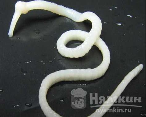 Что делать, если у ребенка обнаружены глисты