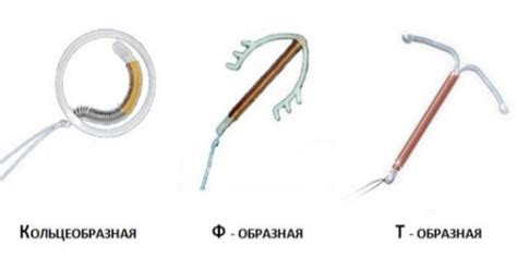 Чувствительность спирали: основные преимущества для обоих партнеров