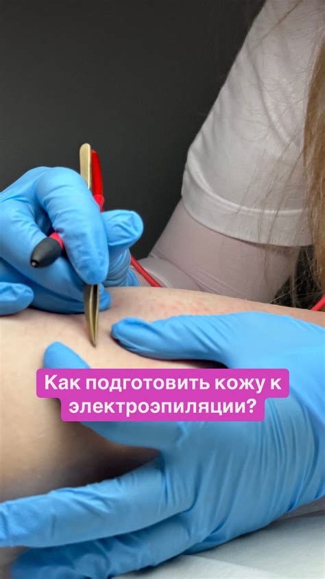 Шаг 1: Подготовка к процедуре