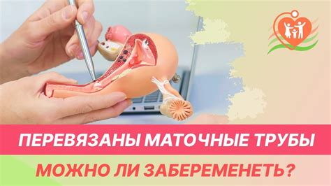 Влияние не дифференцированных маточных труб на репродуктивную функцию