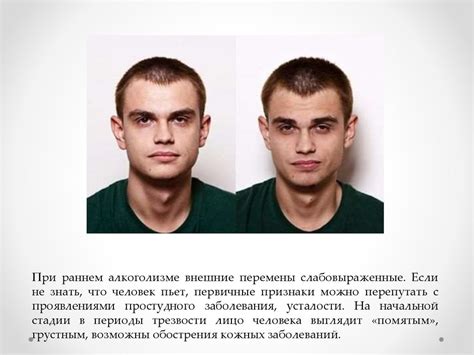 Влияние плоского лица на внешность и самооценку