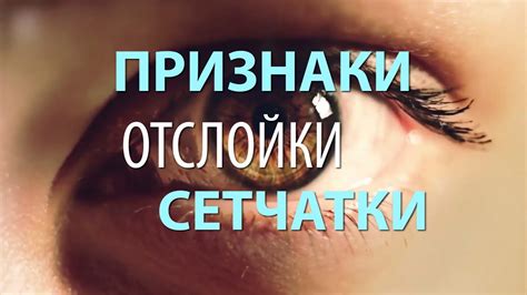 Внешние признаки милахи