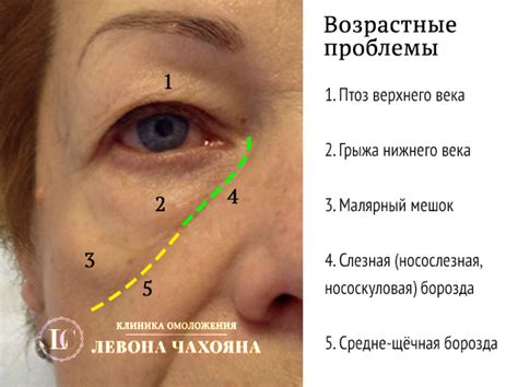 Внутренние причины появления мешка под правым глазом
